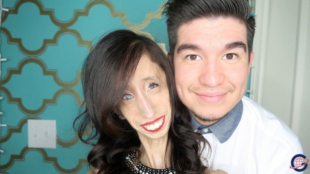 Lizzie Velasquez Husband