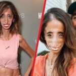 Lizzie Velasquez Husband