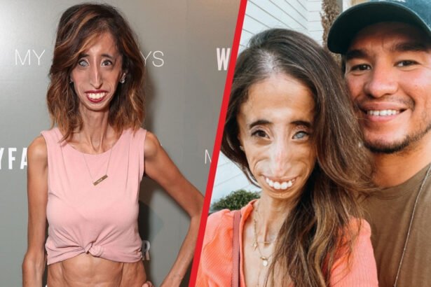 Lizzie Velasquez Husband
