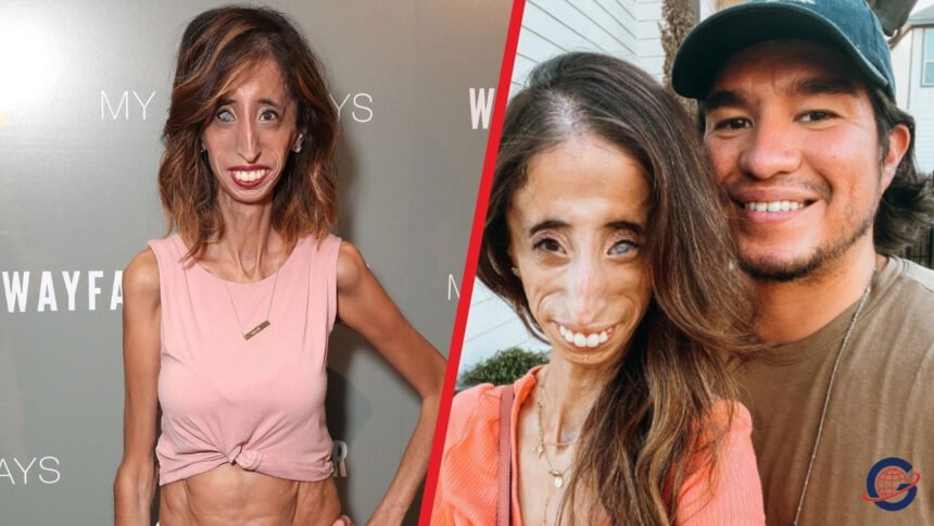 Lizzie Velasquez Husband